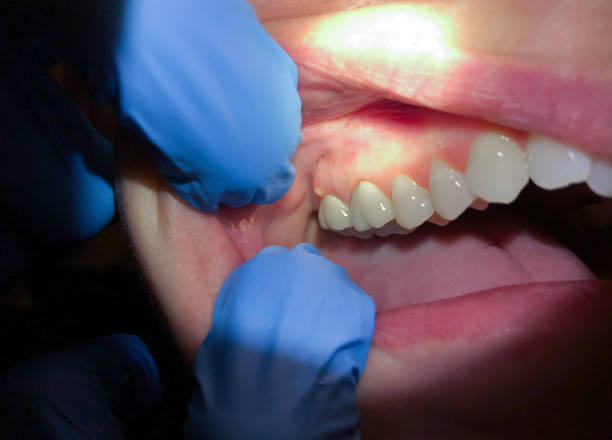 Best Emergency Root Canal Treatment in Mbrian Park, CA