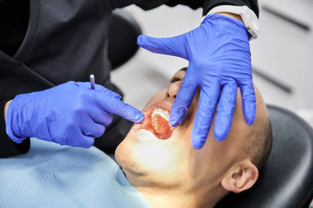 Best Emergency Dental Care for Broken or Chipped Teeth in Mbrian Park, CA