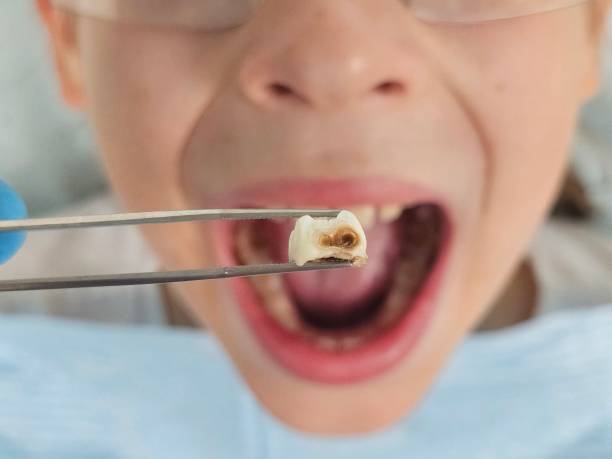 Best Pediatric Emergency Dentist in Mbrian Park, CA